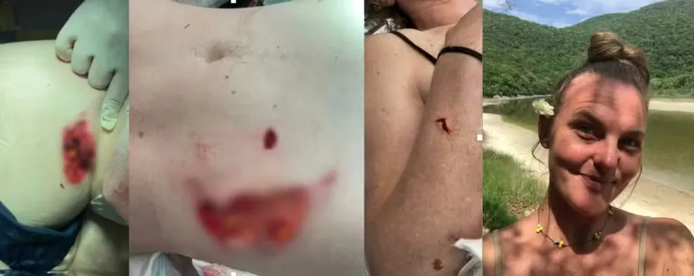 Reprodu&ccedil;&atilde;o/g1