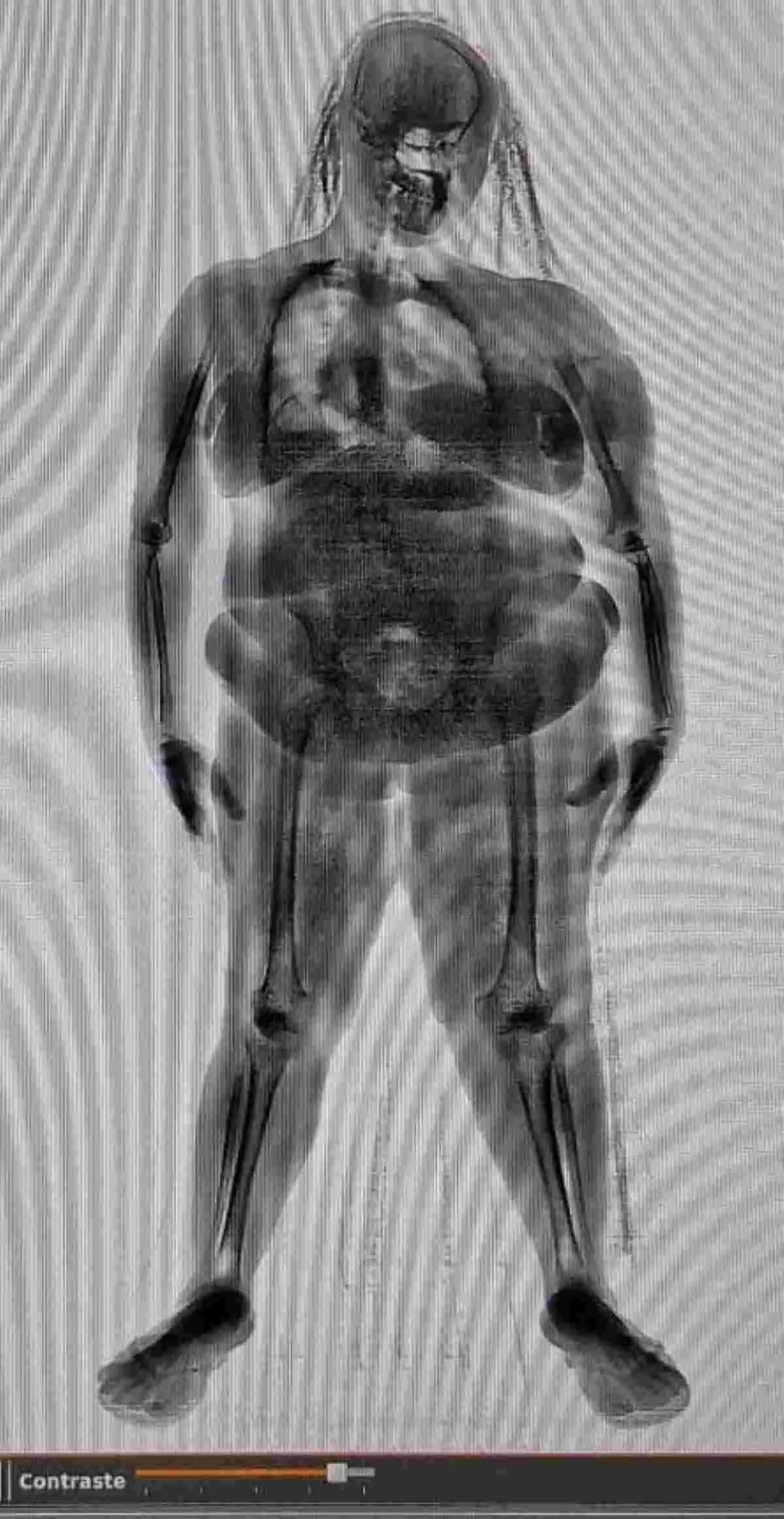 Reprodu&ccedil;&atilde;o/ Seap