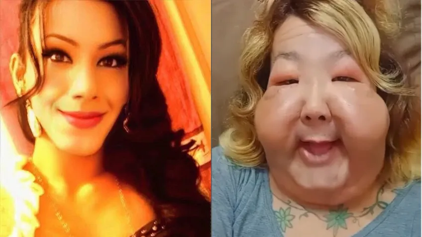 Juju Do Pix Antes E Depois